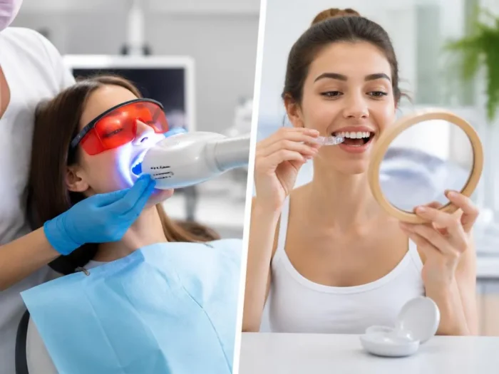 Profesionální vs. domácí bělení zubů: Co se vyplatí?